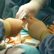 Lipo-abdominoplastika ve t�ech vrstv�ch