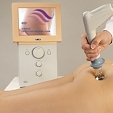 X-WAVE
eXtr�mn� ��inn�
�e�en� celulitidy  
