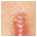 Ostatn� dermatologie