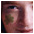 Ostatn� dermatologie