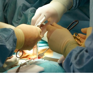 Lipo-abdominoplastika ve třech vrstvách