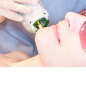 Nebojte se laserů: Omladí vás i zkrásní