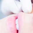 Výplňové implantáty vykouzlí i nový nos