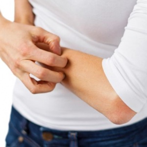 Svědí vás často kůže? Nepřehlížejte to