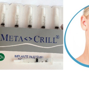 Metacrill konečně v ČR