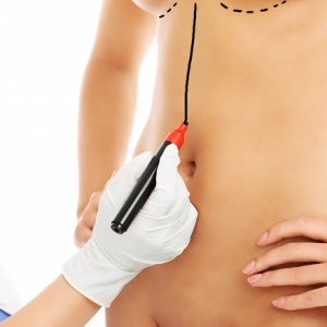 Plastické operace, o kterých se moc nemluví