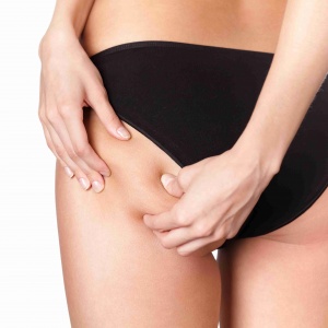 Pravda o liposukci očima odborníka