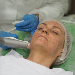 Dokonalá pleť i bez make-upu aneb omlazení na míru