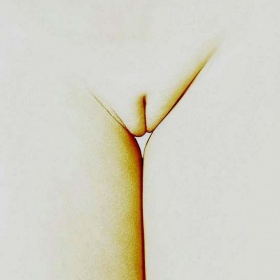 Úprava ženského genitálu