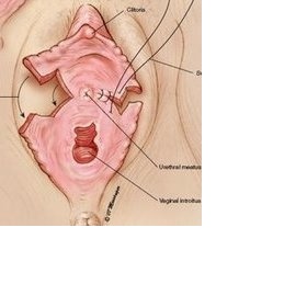Labioplastika - metody zákroku
