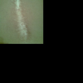 Rada jak účinně a na delší dobu zakrýt i velkou jizvu