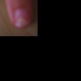 Bílý  konec nehtu do písmena V