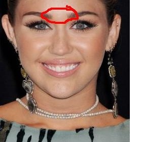 Co znamená, když se akné tvoří hlavně v okolí nad nosem a krajem obočí