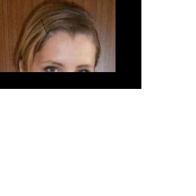 Vlasy nad čelem rostou do špičky