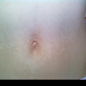 Bílé rozrůstající flíčky