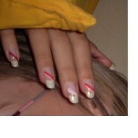 Vlasy rostou moc pomalu, nehty moc rychle