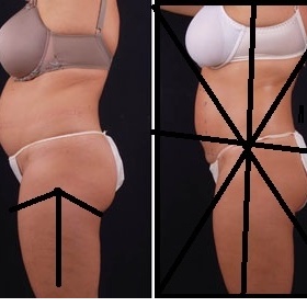 Chci zhubnout v 15 letech 10 kilo