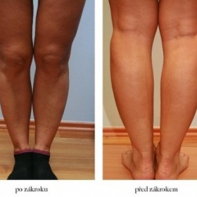 Zhubnout přes stehna, přibrat přes lýtka - jde to vůbec?
