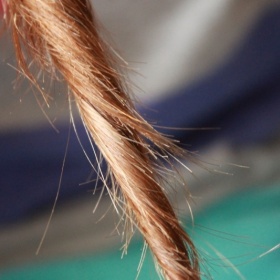 Bílé tečky ve vlasech