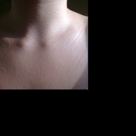 Nemizící husí kůže na krku a v dekoltu