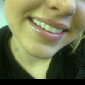 MUDr.Kahánek Petr Brno - keramické korunky