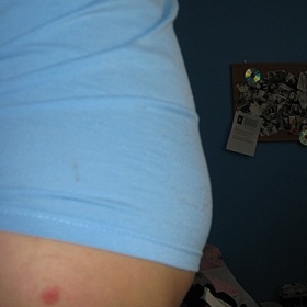 Jak se zbavit bříška při cukrovce?