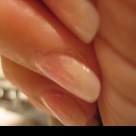 Špatná přilnavost tipu na nehet