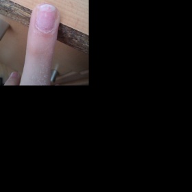 Bílá skvrna na nehtu - co to je?