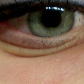 Oteklé oči celý den