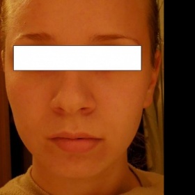 Nemůžu poznat tvar svého obličeje