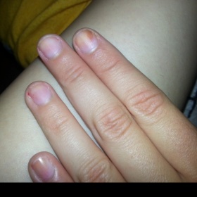 Skvrny na nehtech z laku Colorama