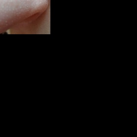 Ucpané póry až husté šupinky