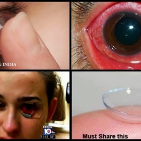 Vznícení kontaktních čoček v blízkosti ohně.