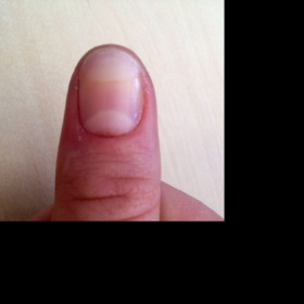 Nahnědlý oblouček na nehtu