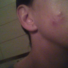 Svědivý opar na tváři