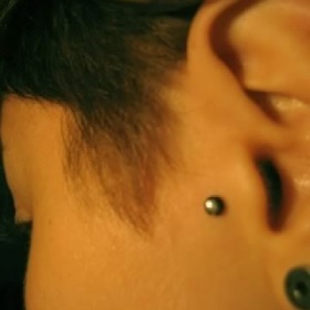 Microdermal u ušního boltce