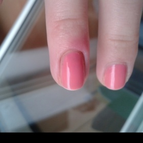 Zánět nehtového lůžka