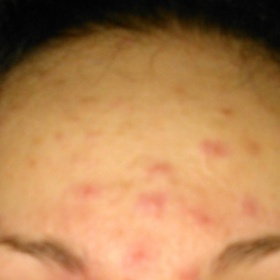 Boláky, fleky a bolavá místa