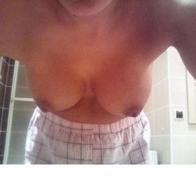 Posouzení augmentace prsou 2 měsíce po operaci