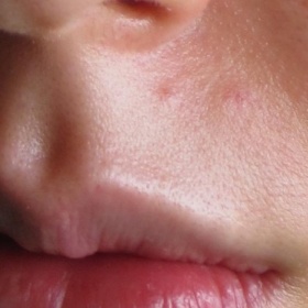 Vrásky ve velmi mladém věku