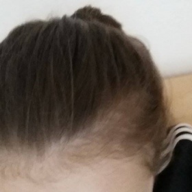 Podrůstají mi vlasy