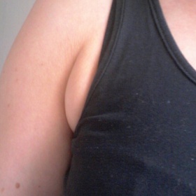 Jak se zbavit špeku v podpaží