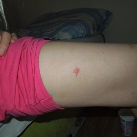 Štěnice nebo blecha?