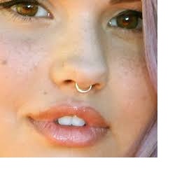 Propíchnutí septumu 6 let po operaci nosu