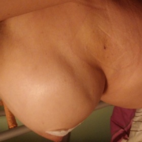 Prohloubenina na jednom prsu. Co je to?