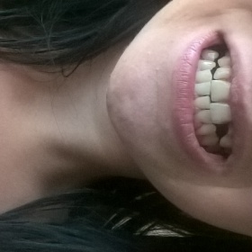 Rovnátka, ano nebo ne?