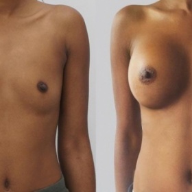 Operuje MUDr.Trupar i v Olomouci?