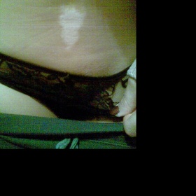 Zářivá 'jizva' v podbříšku