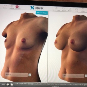 MUDr. Juraj Payer a Motiva