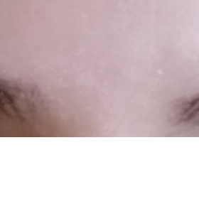 Špatný směr růstu obočí